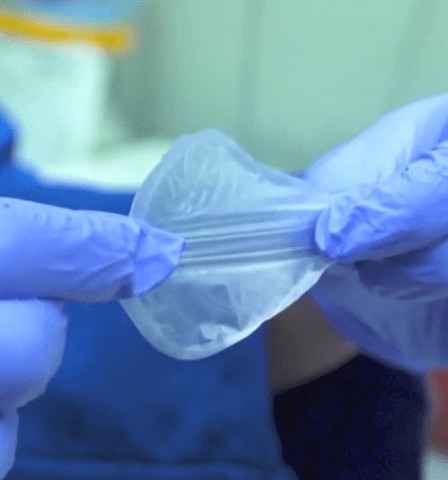 rankos, liečiančios pirminį plastiką